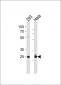 AP7518d-CDK2-Antibody-T14