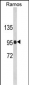 AP6965b-CR2-Antibody-C-term