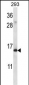 AP14541b-RPS19-Antibody-C-term
