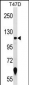 AP16255a-ZNF217-Antibody-N-term