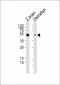 AP20618a-DANRE-gfap-Antibody-N-term