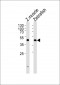 Azb18712c-DANRE-dixdc1a-Antibody-Center