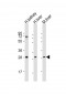 AP6242a-SIRT3-Antibody-C-term