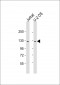 AP10947b-CENTG1-Antibody-C-term