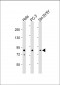 AP7555a-DYRK1A-Antibody-N-term