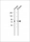 AP7219b-DCAMKL1-Antibody-C-term